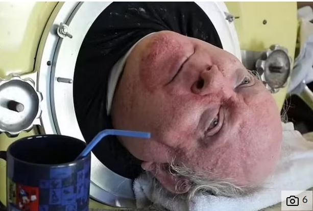 ७० बर्ष देखी फलामको बक्सामा रहेका ‘आयरन लङ्ग मैन’को निधन